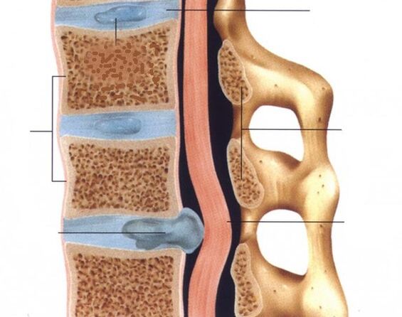 Hernias are pronounced