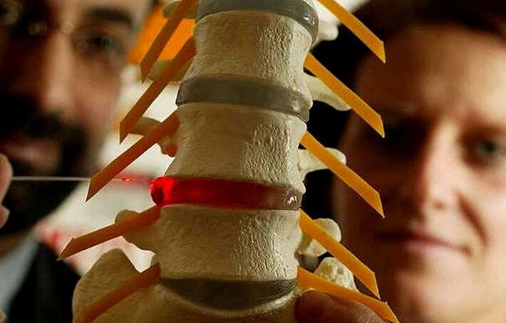 changes in intervertebral disc integrity