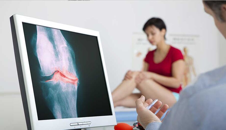 Seeing a doctor if arthritis or osteoarthritis is suspected