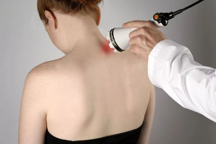 Physiotherapy for osteochondrosis