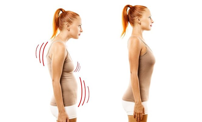 leaning as a cause for the development of lumbar osteochondrosis