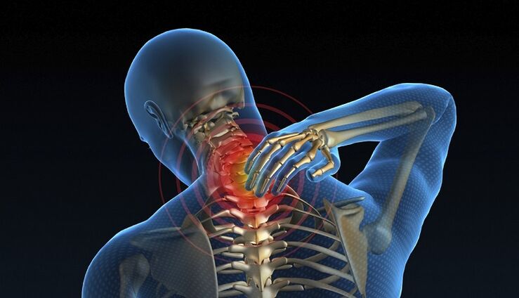 pinched nerve in the spine as a cause of low back pain