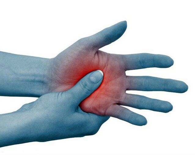 Severe pain in the finger joints, which eases with exercise, is a typical sign of rheumatoid arthritis.