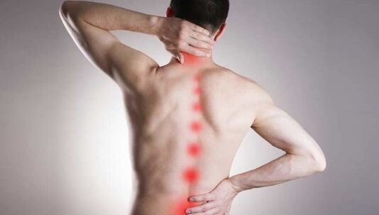 Osteochondrosis symptoms